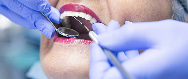 Best Emergency Dental Care for Sports Injuries in Cleveland, FL